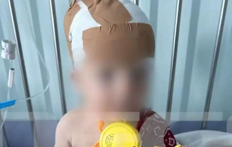 Νέα Σμύρνη: «Σκύλος επιτέθηκε σε μωρό 11 μηνών»...VIDEO