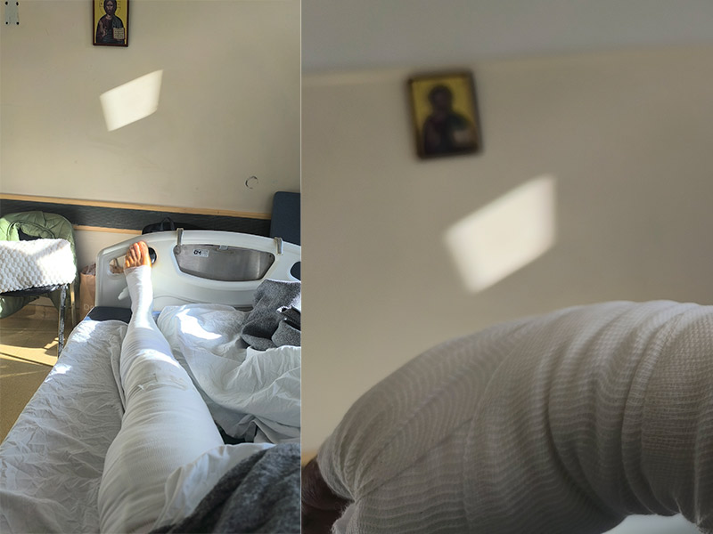 Ιωάννινα:Τραυματισμός κυνηγού από αγριογούρουνο