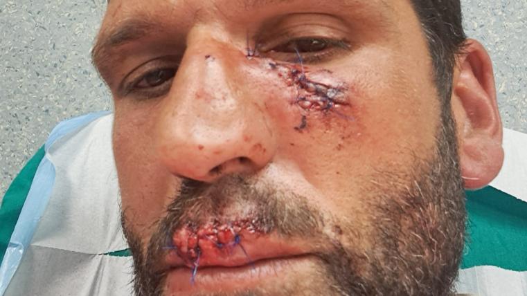 Ιταλία : Επίθεση λύκου σε αγρότη....VIDEO