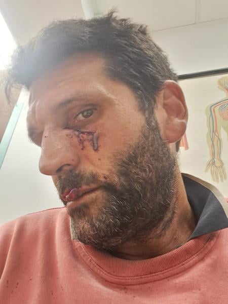 Ιταλία : Επίθεση λύκου σε αγρότη.