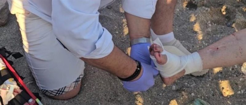 Ανάβυσσος: Σοβαρός τραυματισμός λουόμενης - Θαλάσσια χελώνα έκοψε το δάχτυλο της